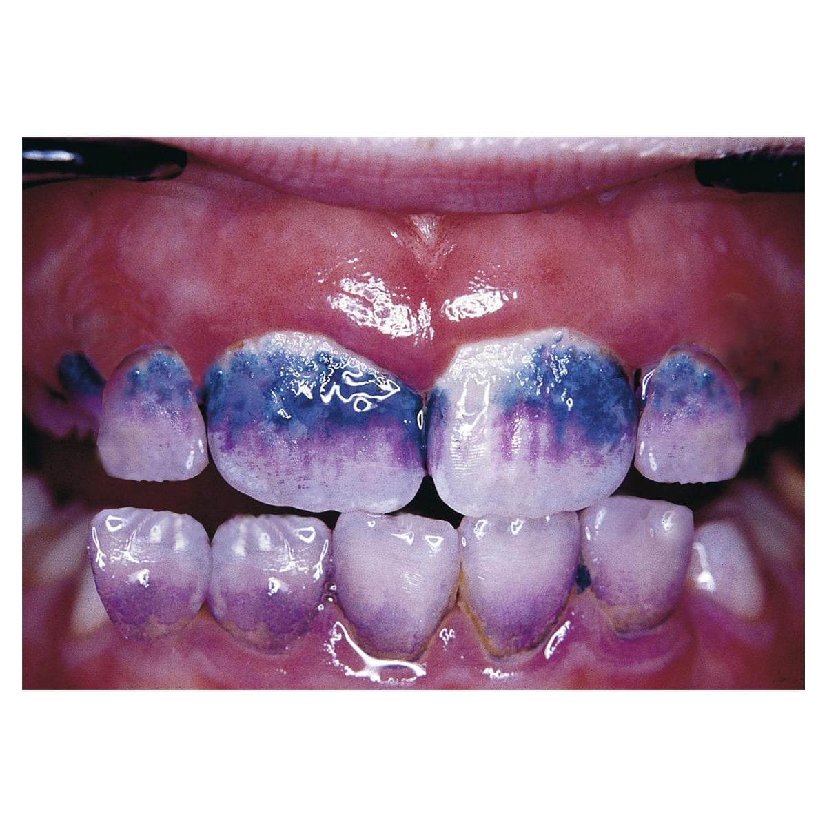 Mira-2-Ton® - Flasche 12 x10 ml