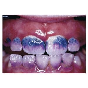 Mira-2-Ton® - Flasche 12 x10 ml