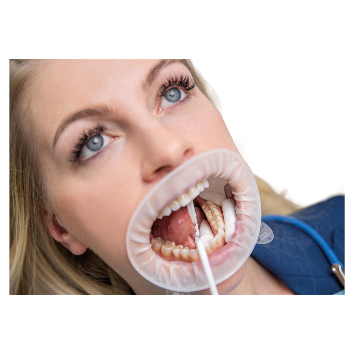 OptraGate® - Nachfüllpackung - Regular, Packung 80 Stück