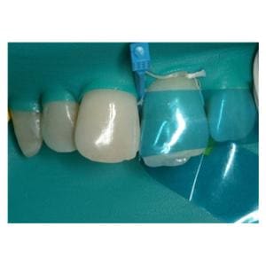 Blue View VariStrip Frontzahnmatrizen - Polyester (VS1), Packung 100 Stück