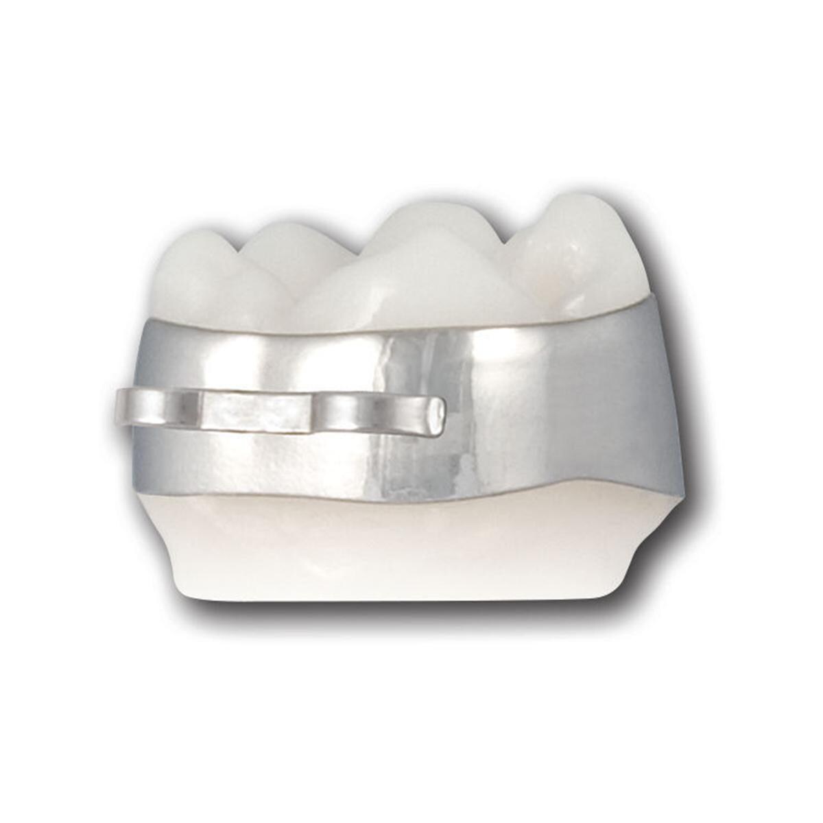 Vorgeschweißtes Häkchen - Attachment für Molaren