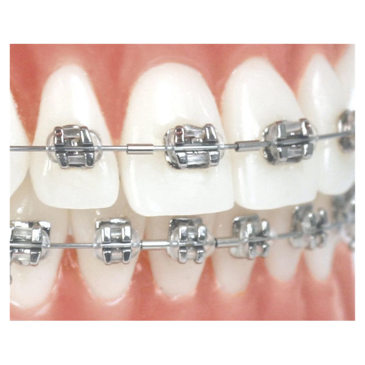 Klemmbare Mini-Stopps für Rundbögen - Packung 25 Stück