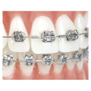 Klemmbare Mini-Stopps für Rundbögen - Packung 25 Stück