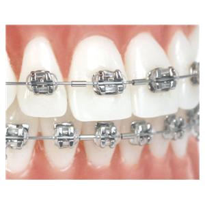 Klemmbare Mini-Stopps für rechteckige Bögen - Packung 25 Stück