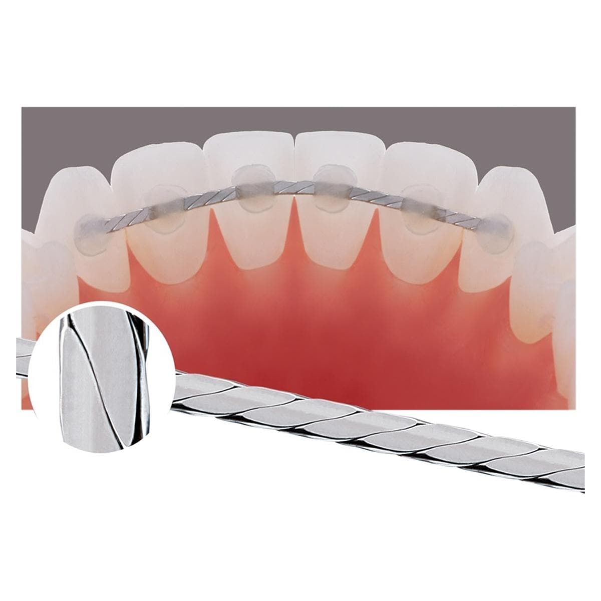 Geflochtener Retainer-Draht - Packung 10 Stück