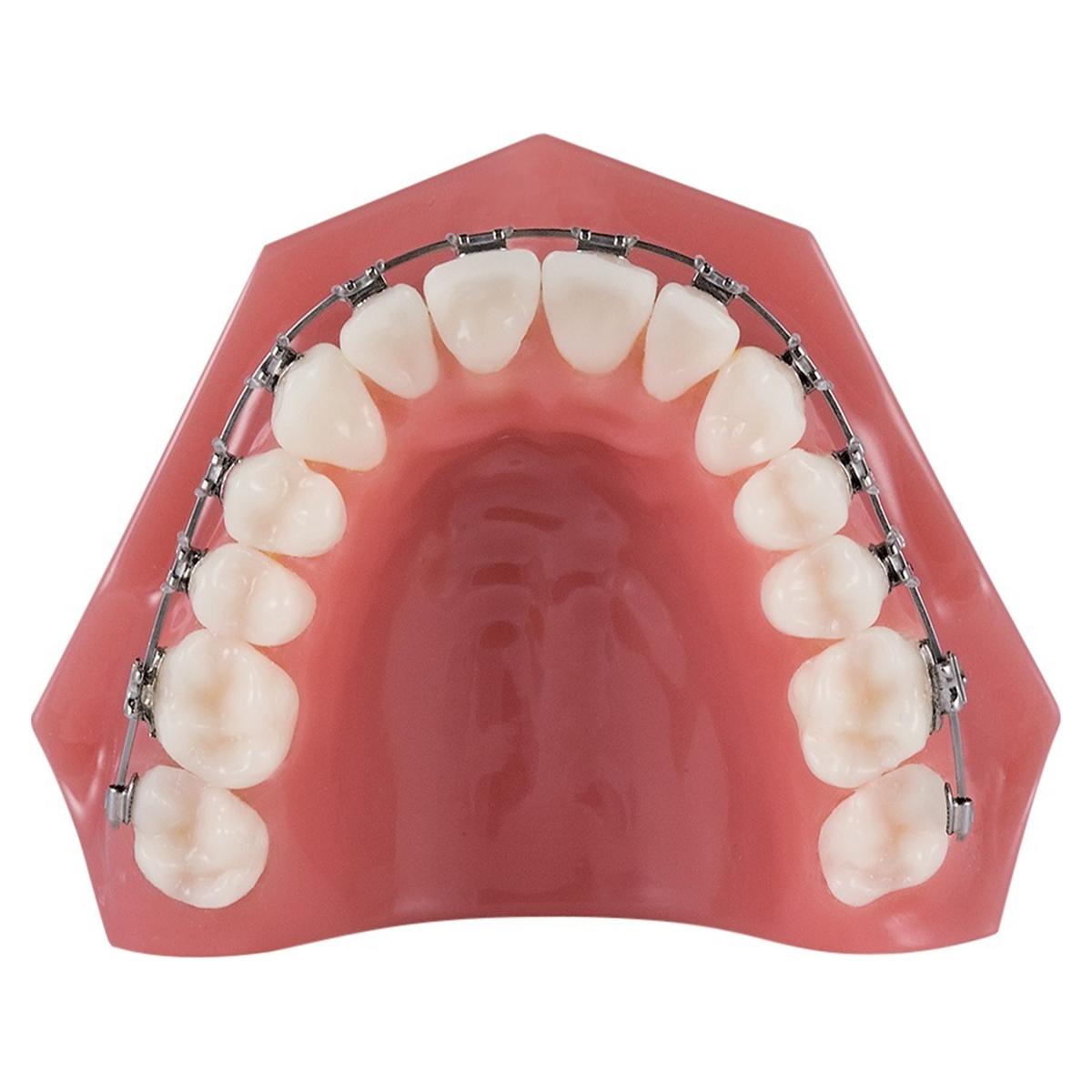 TruFlex™ Thermoelastische Nickel-Titan Drahtbögen – Full-Form, rund, geätzt - OK, Ø .020"