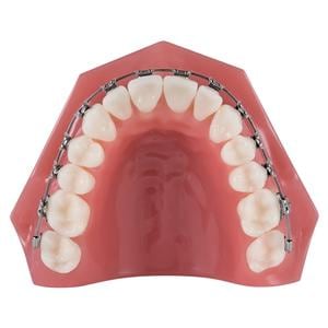 TruFlex™ Thermoelastische Nickel-Titan Drahtbögen – Full-Form, rund, geätzt - OK, Ø .020"