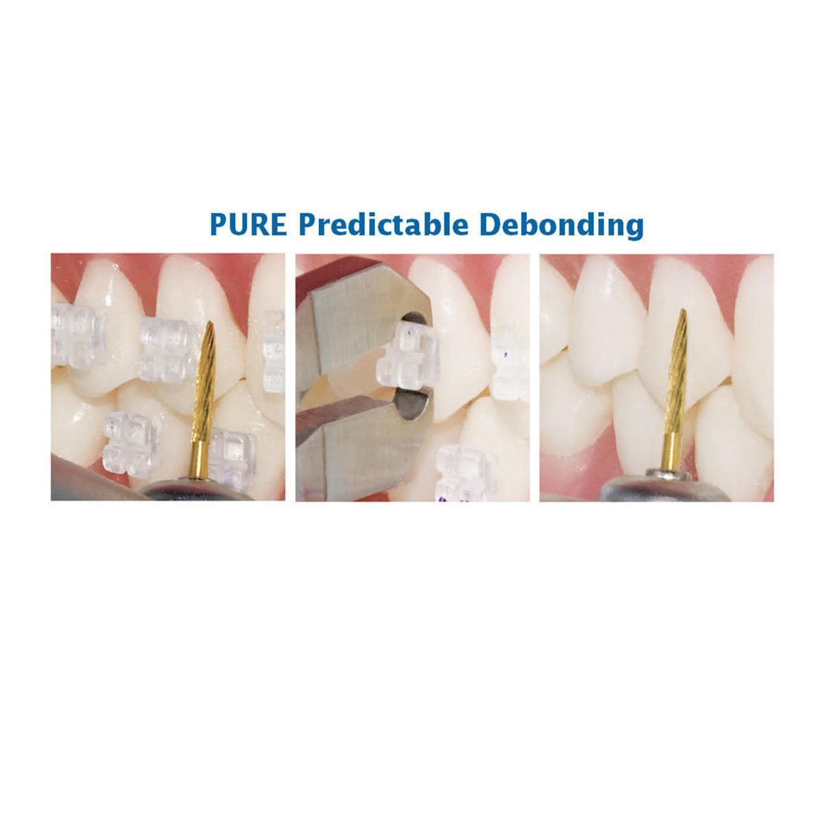 Pure Roth Prescription .018" Slot, Einzelpackung - Zahn 13, 0° Torque, mit Häkchen