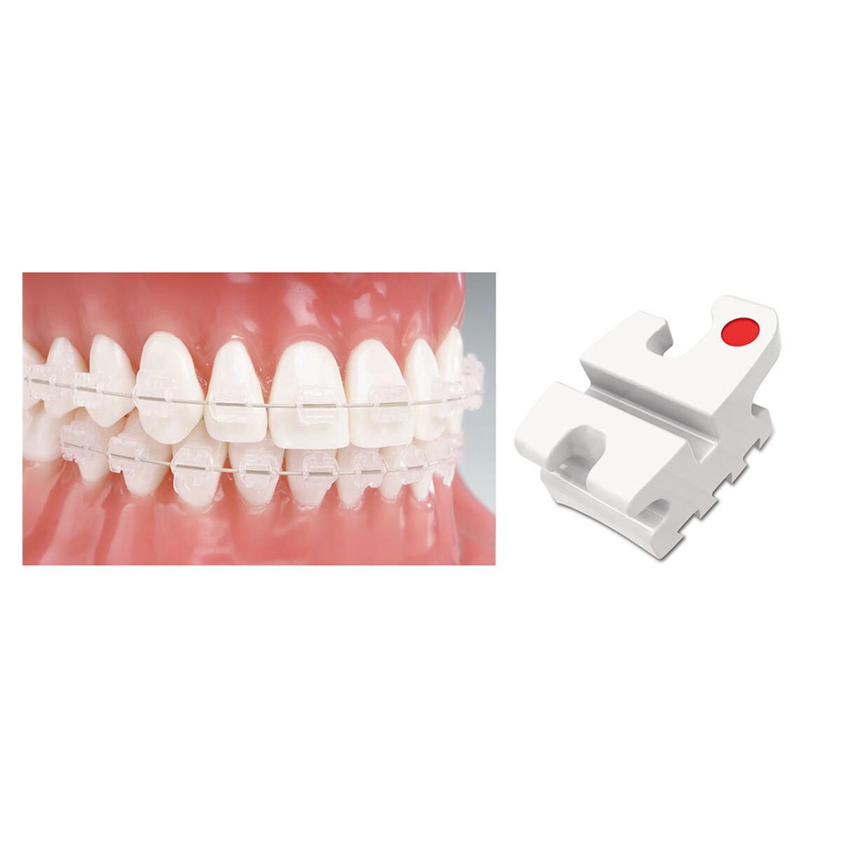 Reflections MBT Prescription .022" Slot, Einzelpackung - Zahn 23 0° Torque, mit Häkchen