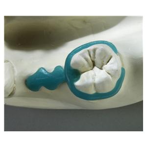 GEO Molaren-Klammern - Selbstklebend, Packung 200 Stück