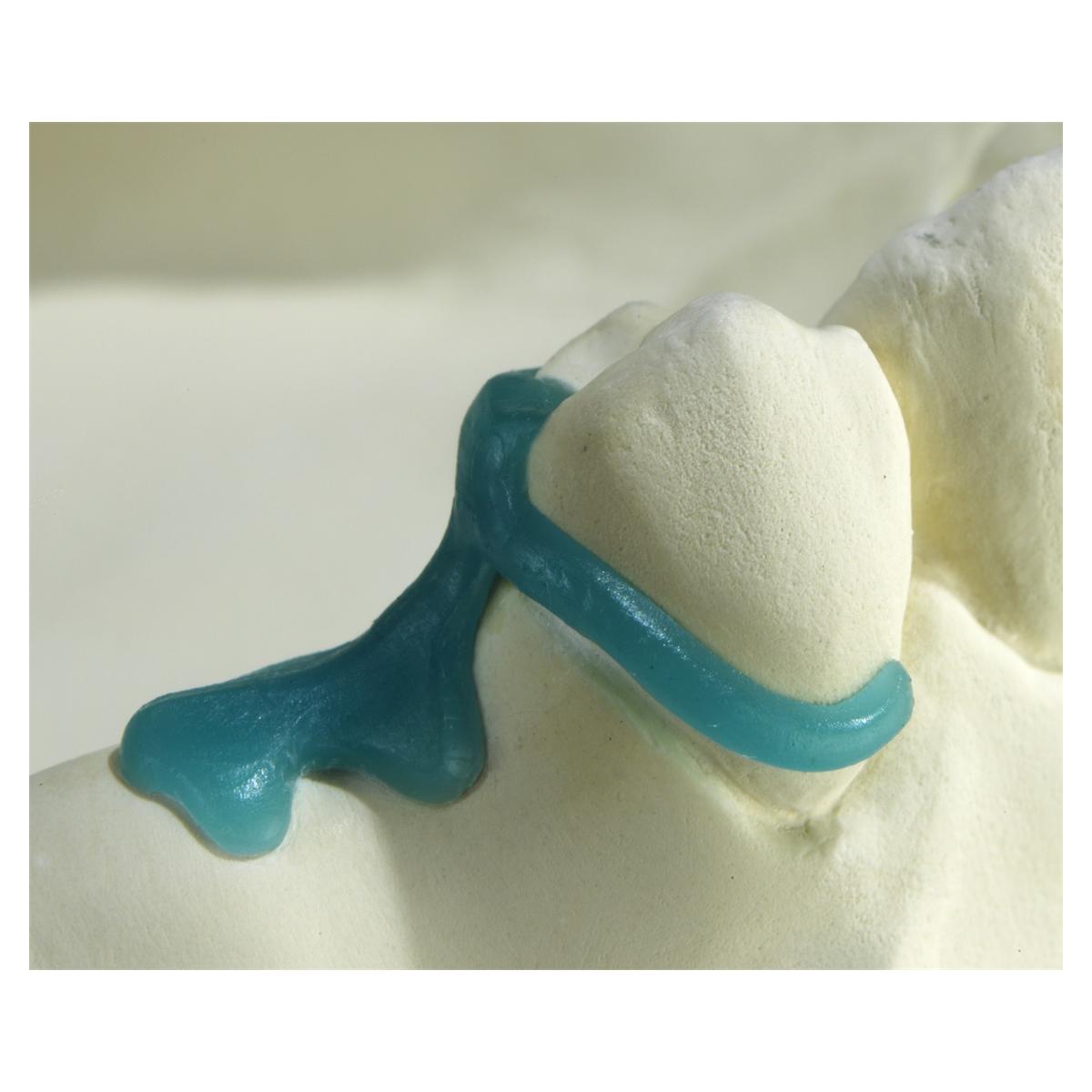 GEO Prämolaren-Klammern - Normal, Packung 200 Stück