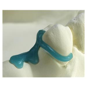 GEO Prämolaren-Klammern - Normal, Packung 200 Stück