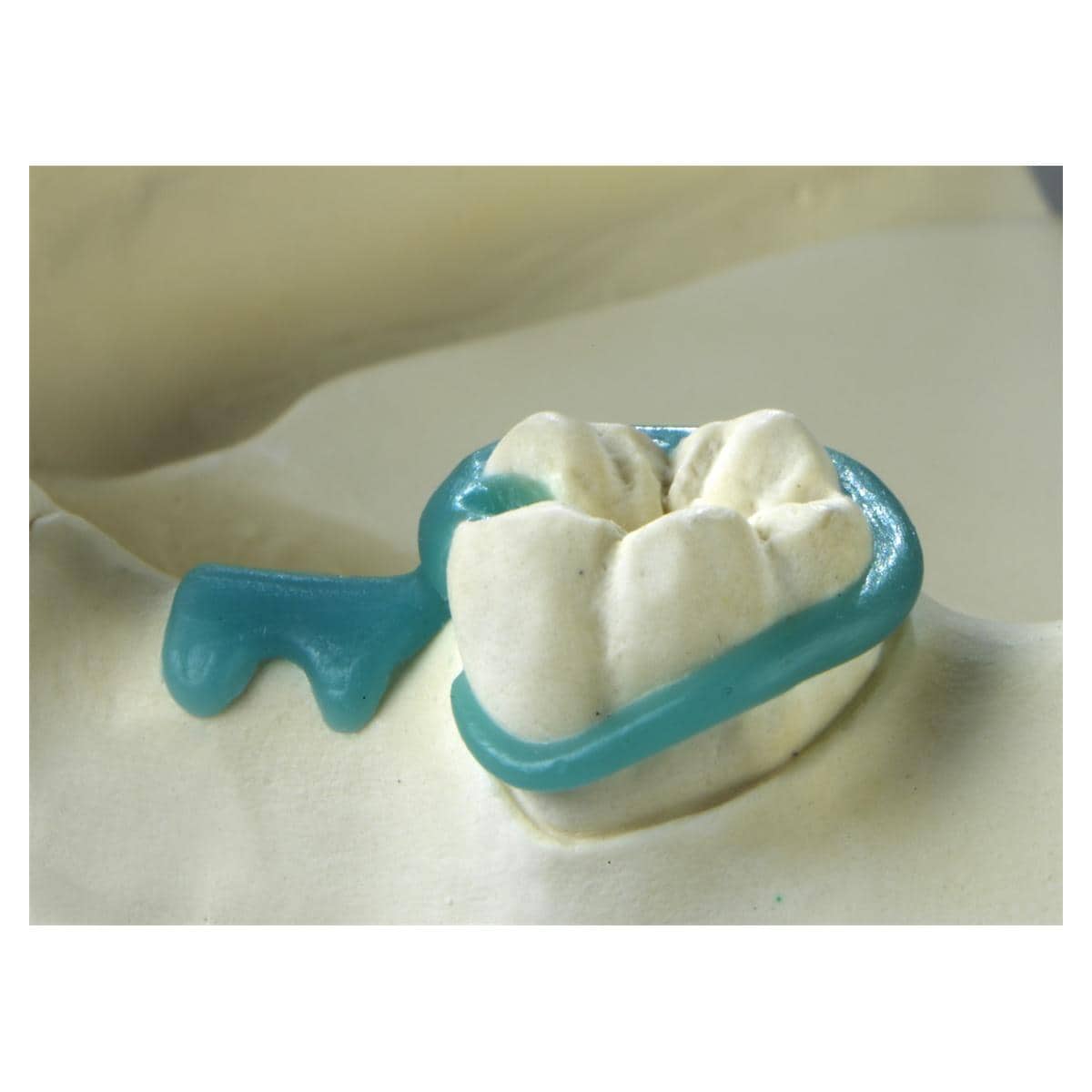 GEO Ringklammern gebogen - Packung 200 Stück