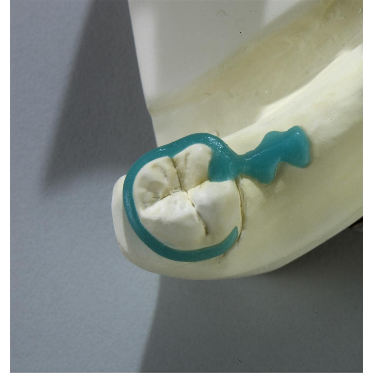 GEO Ringklammern gerade - Packung 200 Stück