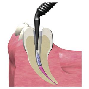 Microbrush® X - Spender Kit - Set