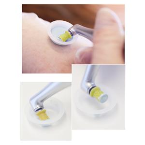 ProphyCare Prophy Cup - Screw-in, Packung 144 Stück