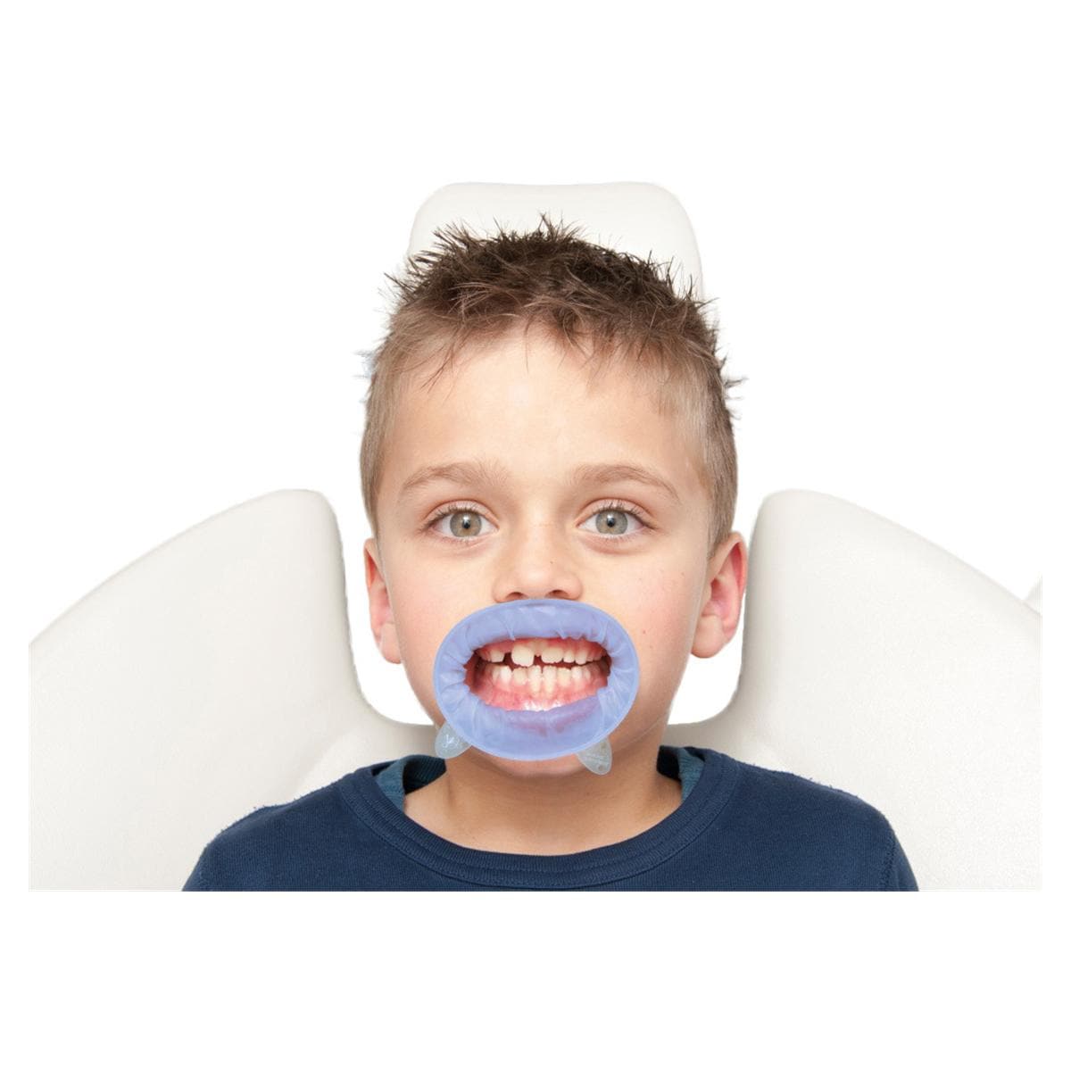 OptraGate® blau und pink - Sortiment - Small