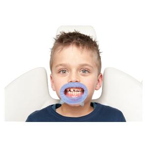 OptraGate® blau und pink - Sortiment - Small