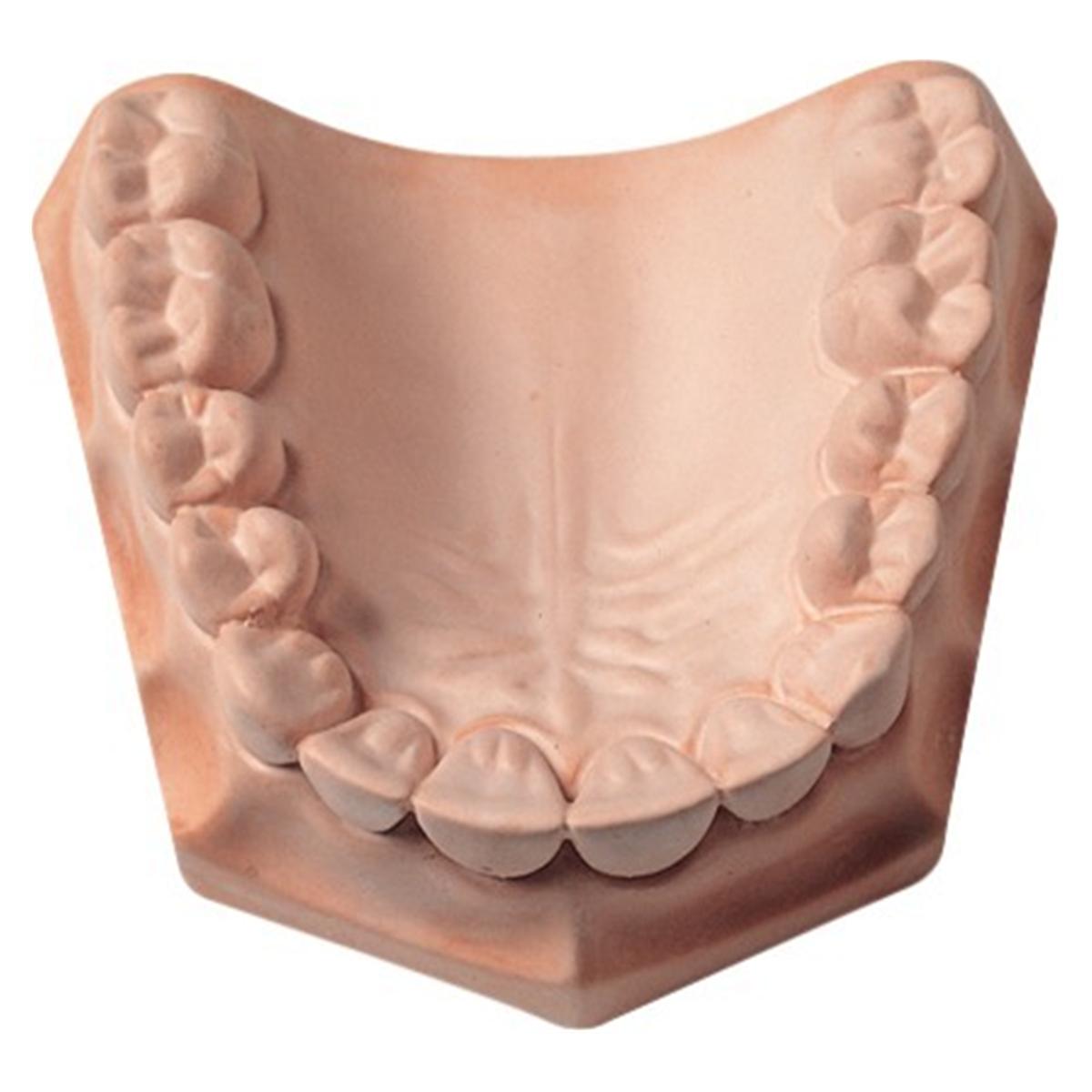 SnapStone, rosa - Karton 15 kg