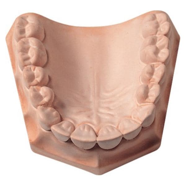 SnapStone, rosa - Karton 15 kg