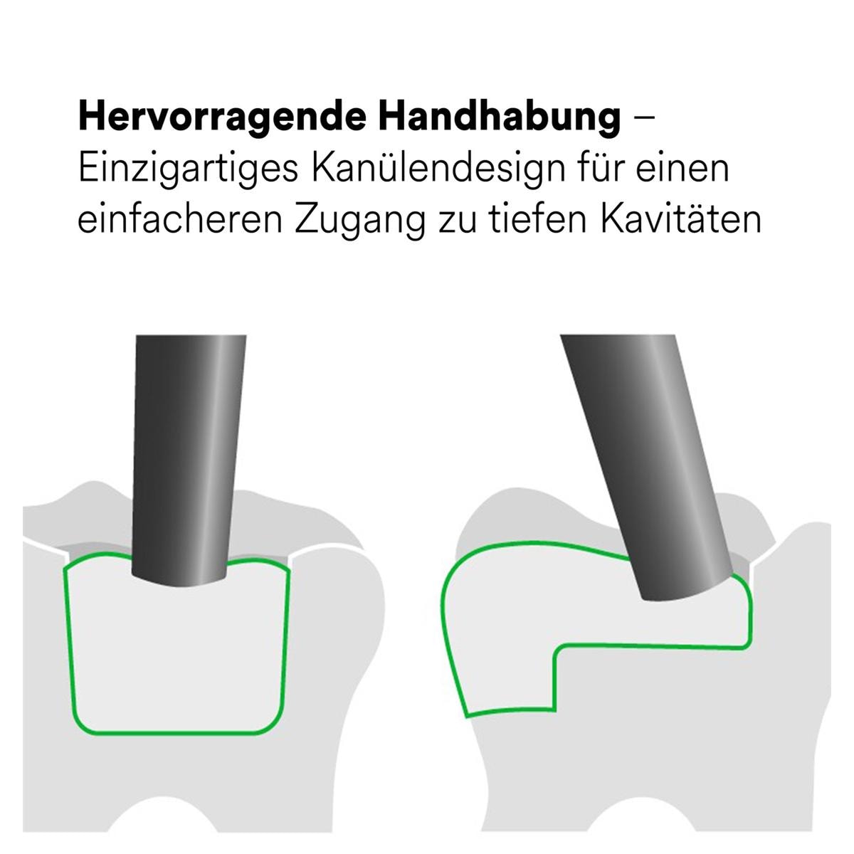 3M™ Filtek™ One Bulk Fill, Kapseln - A1, Kapseln 20 x 0,2 g