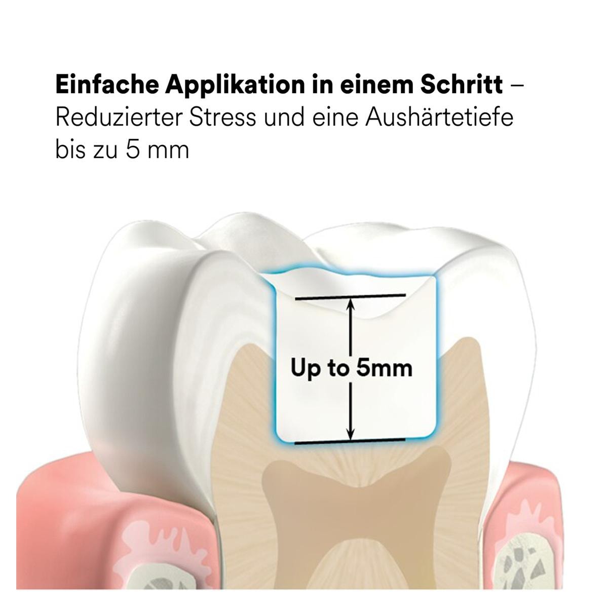 3M™ Filtek™ One Bulk Fill, Kapseln - A1, Kapseln 20 x 0,2 g