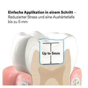 3M™ Filtek™ One Bulk Fill, Kapseln - A1, Kapseln 20 x 0,2 g