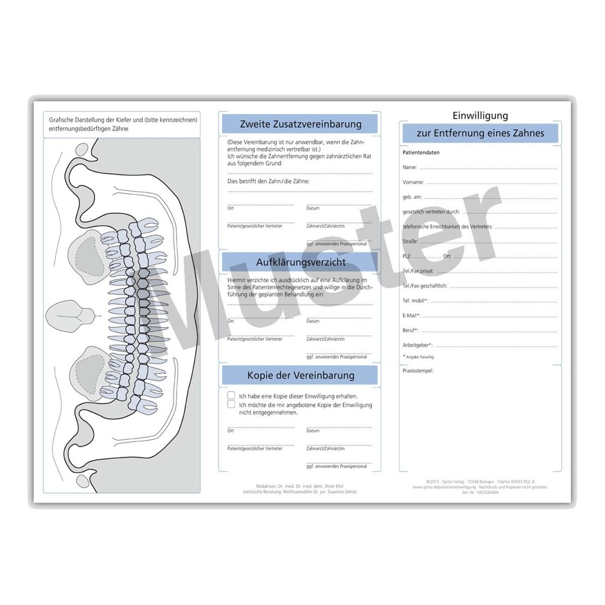 Einwilligung zur Entfernung eines Zahnes - Block 50 Blatt