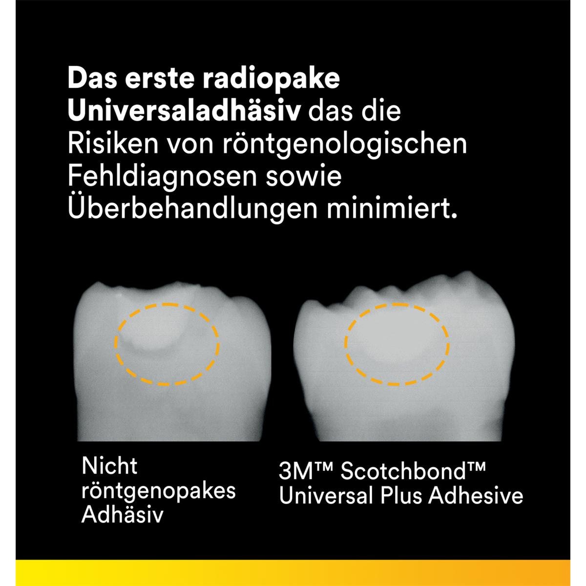3M™ Scotchbond™ Universal Plus Adhäsiv, Flasche - Nachfüllpackung - Flasche 5 ml