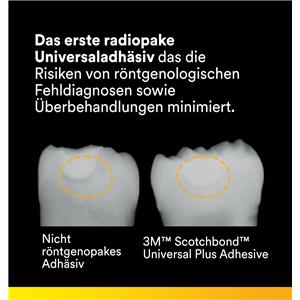 3M™ Scotchbond™ Universal Plus Adhäsiv, Flasche - Nachfüllpackung - Flasche 5 ml
