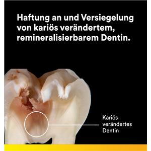 3M™ Scotchbond™ Universal Plus Adhäsiv, Flasche - Nachfüllpackung - Flasche 5 ml