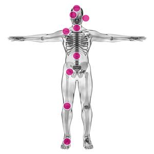 Ora-GUARD - Schmerztherapieschiene