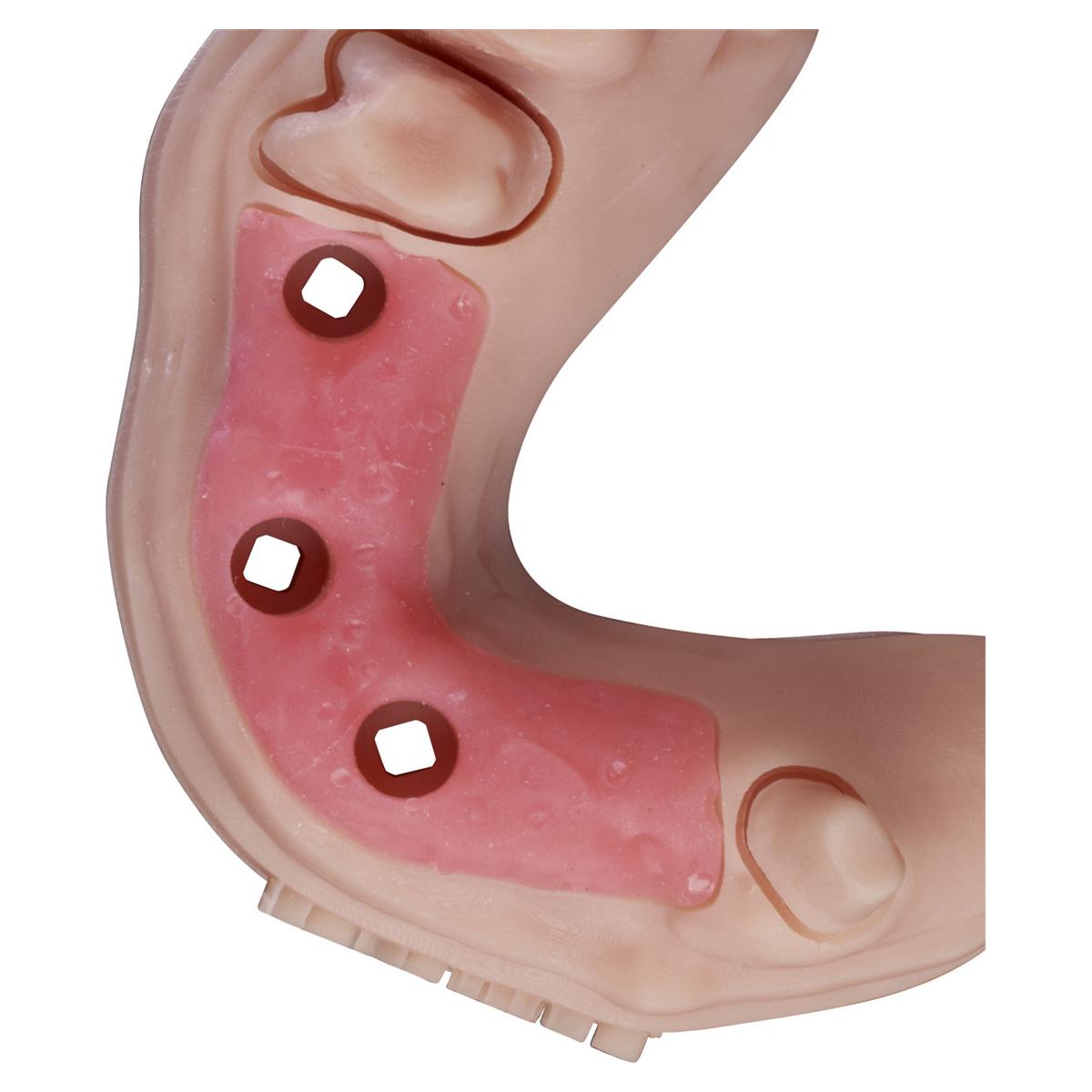 KeyMask® - Flasche 500 g