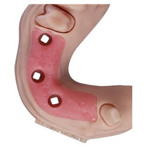 KeyMask® - Flasche 500 g