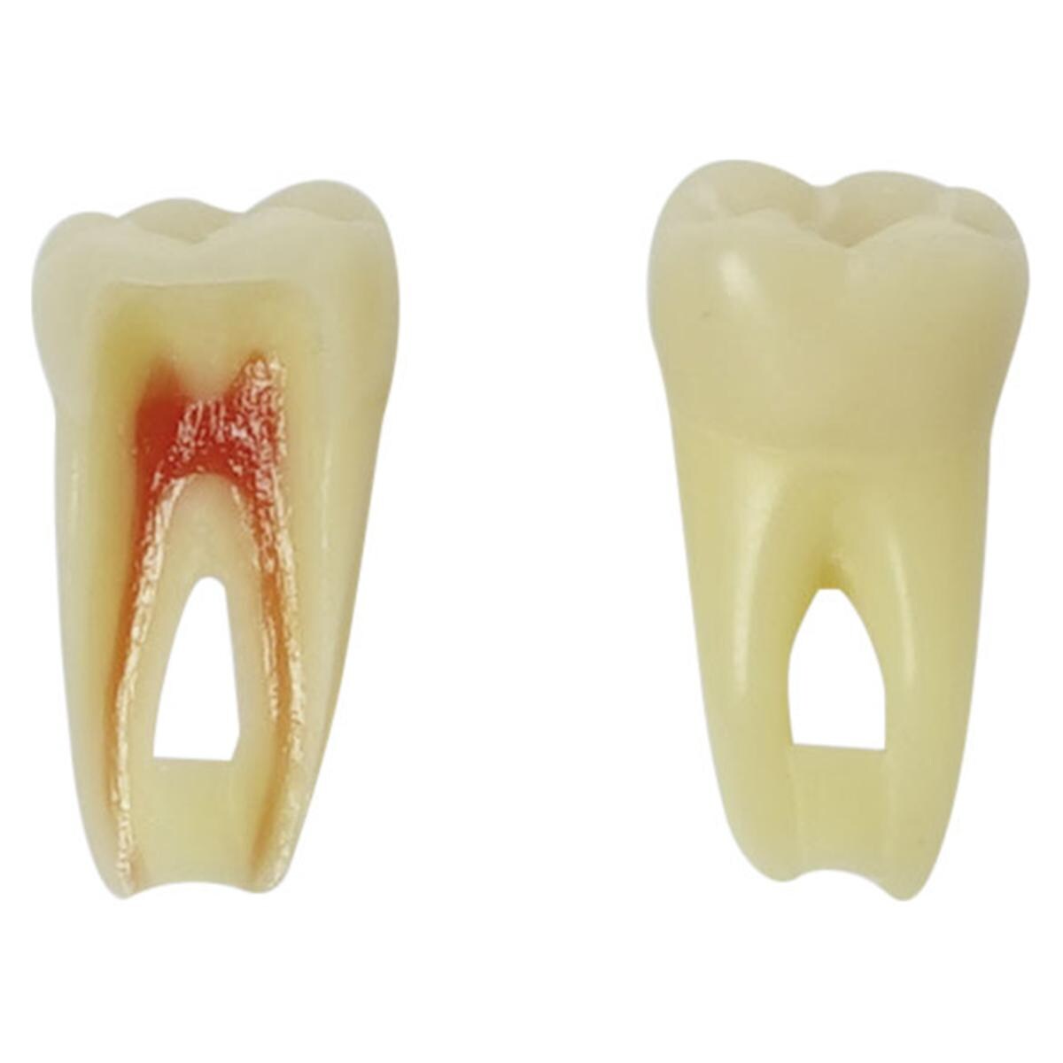Endo-Modellzähne mit Schrauben ANA-4 Z3RN - Zahn 16