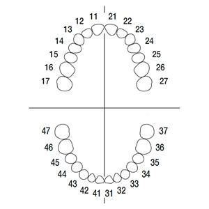 Arbeitsmodell ANA-4 VE 903 - Endodontie Modell Oberkiefer