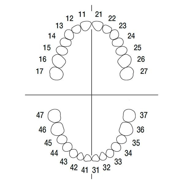 Arbeitsmodell ANA-4 VE 903 - Endodontie Modell Oberkiefer