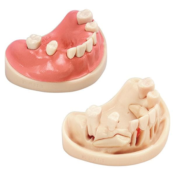 Chirurgie-Trainingsmodell A-J OP - OK