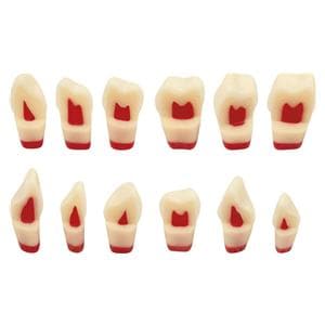 Dreischicht-Zahn ANA-4 ZSDP - Zahn 21