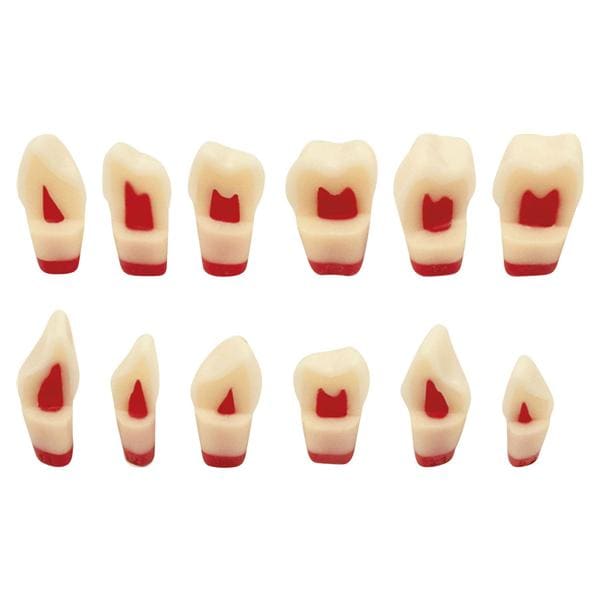 Dreischicht-Zahn ANA-4 ZSDP - Zahn 21