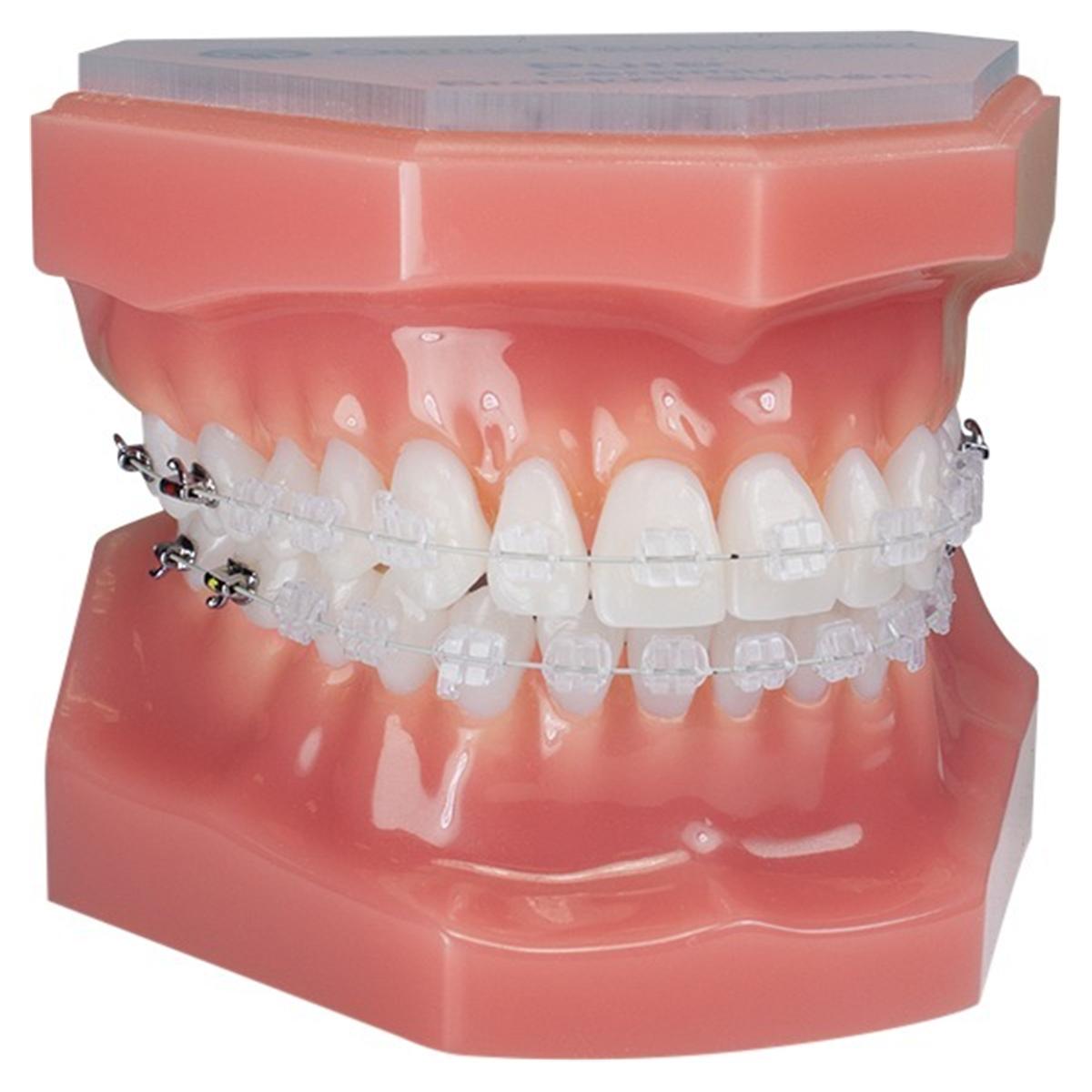 Ortho Technology Typodonten zur Demonstration - Typodont PURE Saphir