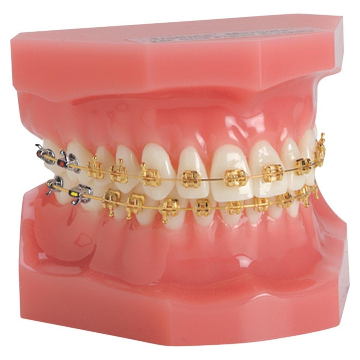 Ortho Technology Typodonten zur Demonstration - Typodont Marquis TruGold