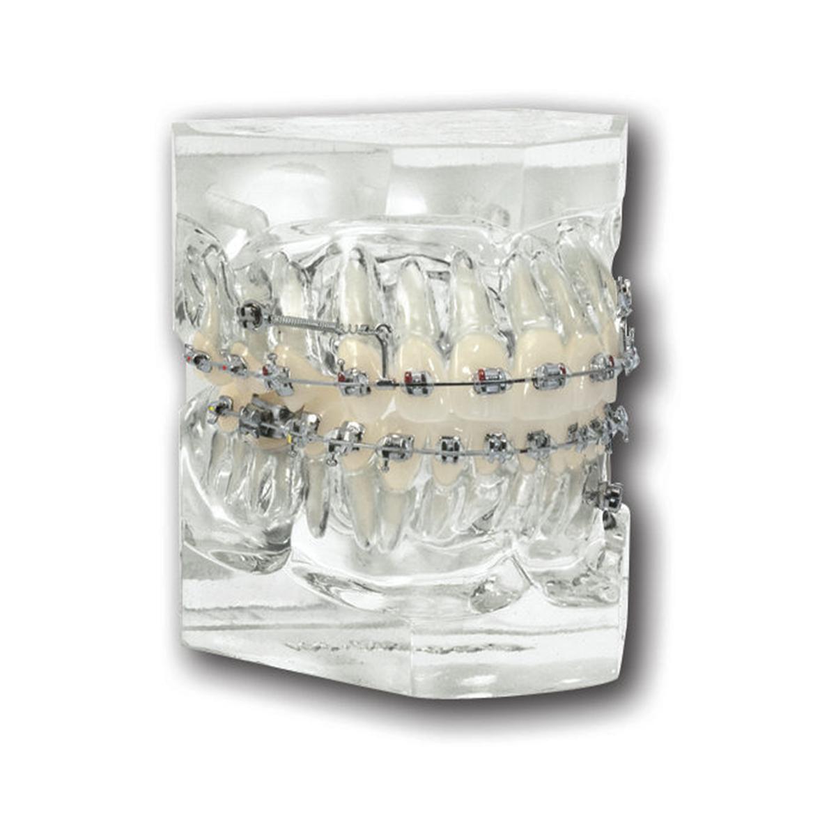 Ortho Technology Typodonten zur Demonstration - Typodont Spider Screw System