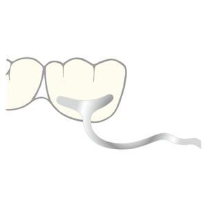 Klammern - Form JM, Ø 1,2 mm, Packung 10 Stück