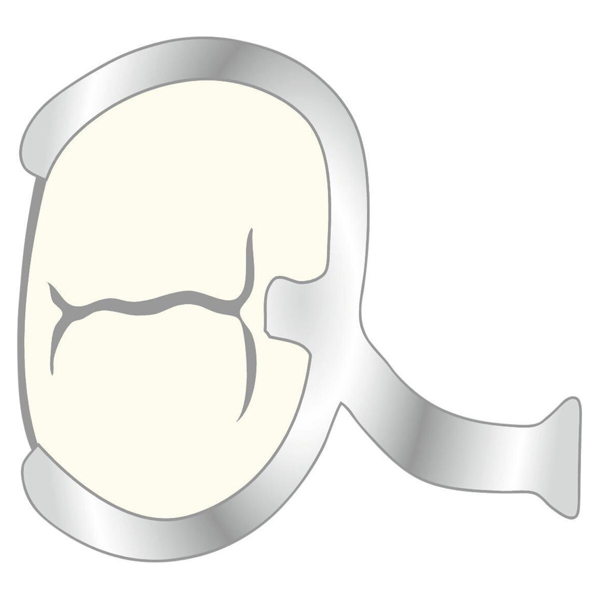 Klammern - Form NK, Ø 0,8 mm, Packung 100 Stück