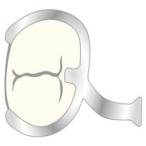 Klammern - Form NK, Ø 0,8 mm, Packung 100 Stück