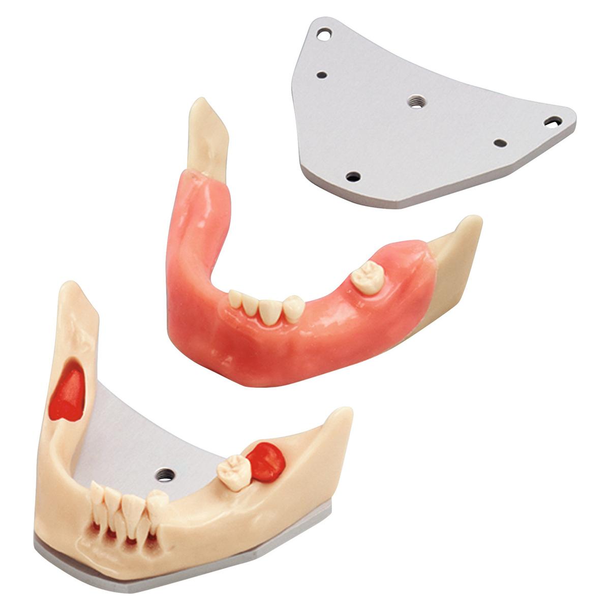 Chirurgie-Trainingsmodell A-J OP - UK