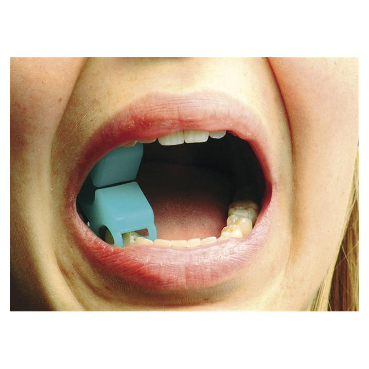 Mirahold®-Block - Mini-Set - Klein, Bissblöcke 3 Stück